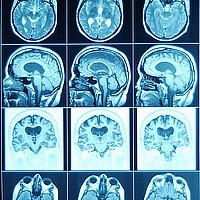 Spiritual Implications of Brain Research
